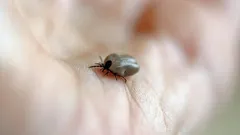 O căpușă pe piele: ce trebuie să faci și la cine să apelezi după o mușcătură